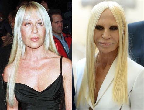 donatella versace before and after|early photos of Donatella Versace.